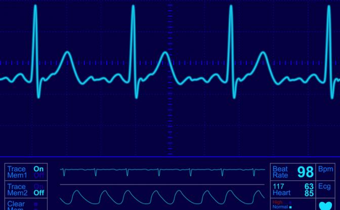 Ломит челюсть? Возможно, это инфаркт…
