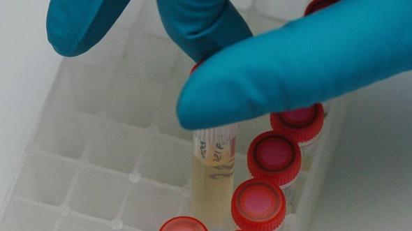 WADA смягчило требования к содержанию мельдони…